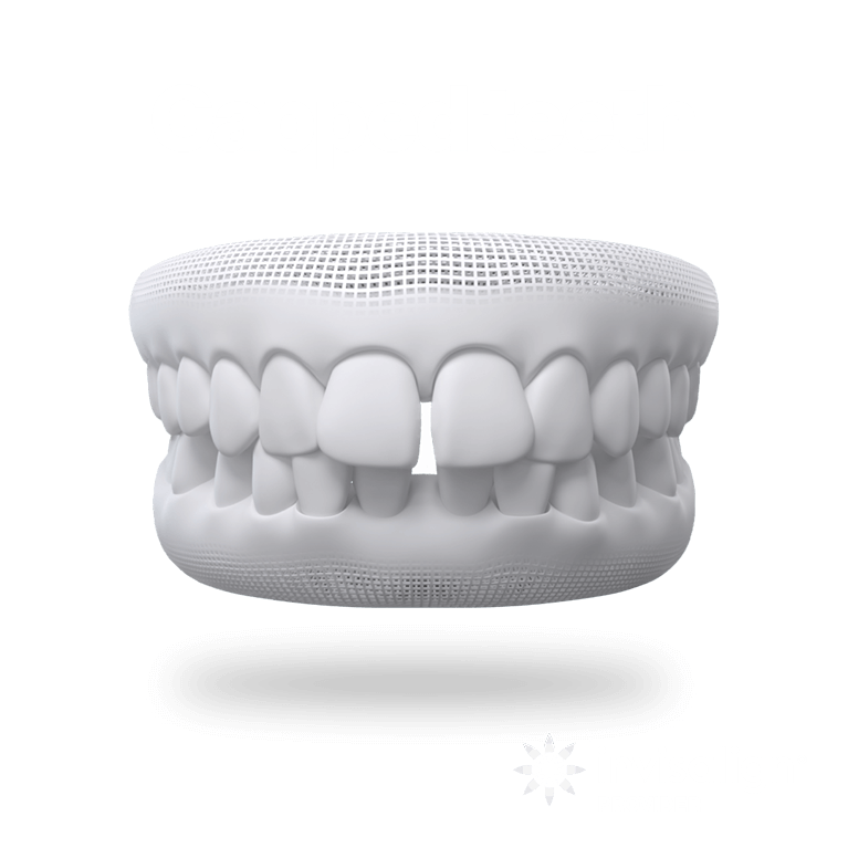 Gapped Teeth