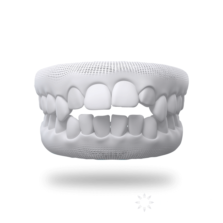 Openbite Teeth