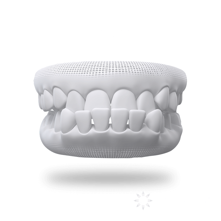 Underbite Teeth